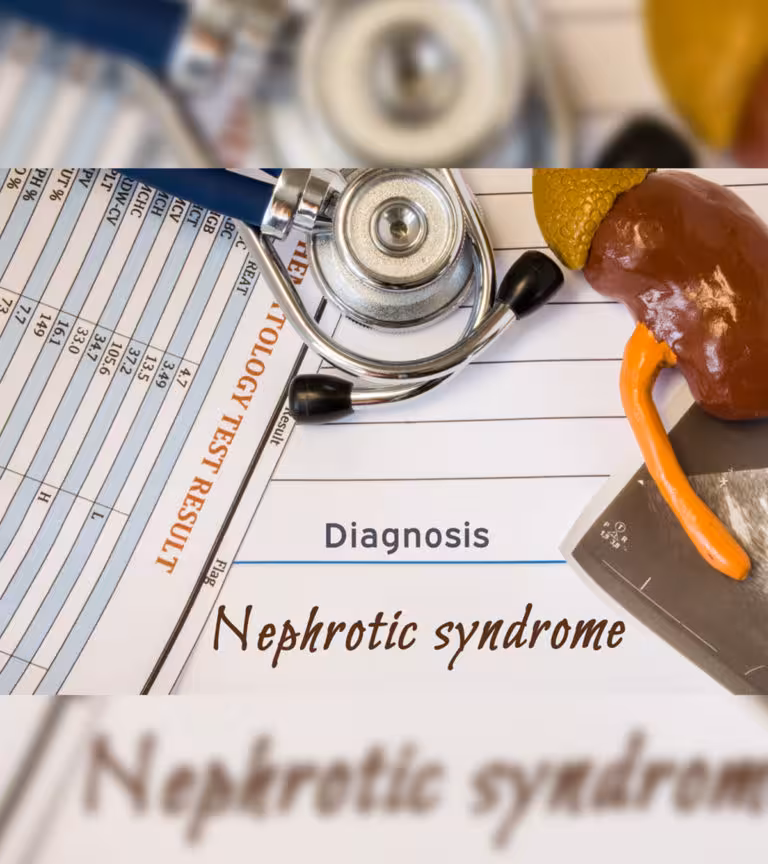 Nephrotic Syndrome In Children