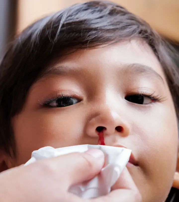 What Causes Nosebleeds In Children And How To Stop Them