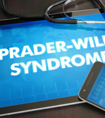 Prader Willi Syndrome Causes, Symptoms, Diagnosis, And Treatment