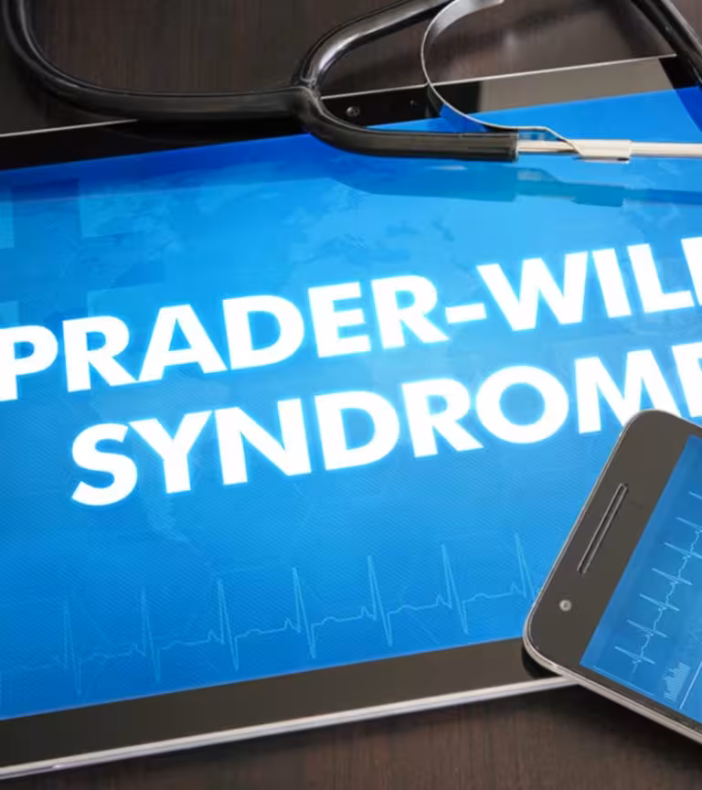 Prader Willi Syndrome Causes, Symptoms, Diagnosis, And Treatment