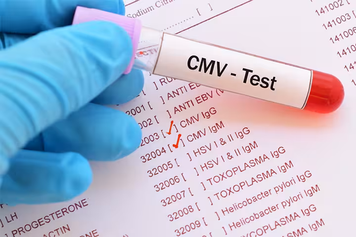 Babies Born With CMV: Symptoms, Causes And Treatment