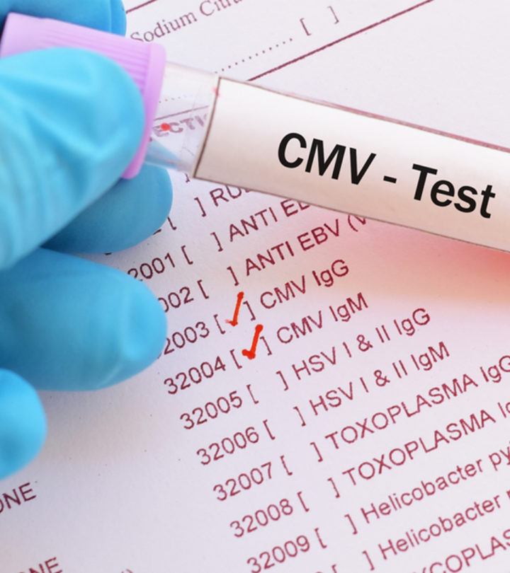 Babies Born With CMV: Symptoms, Causes And Treatment