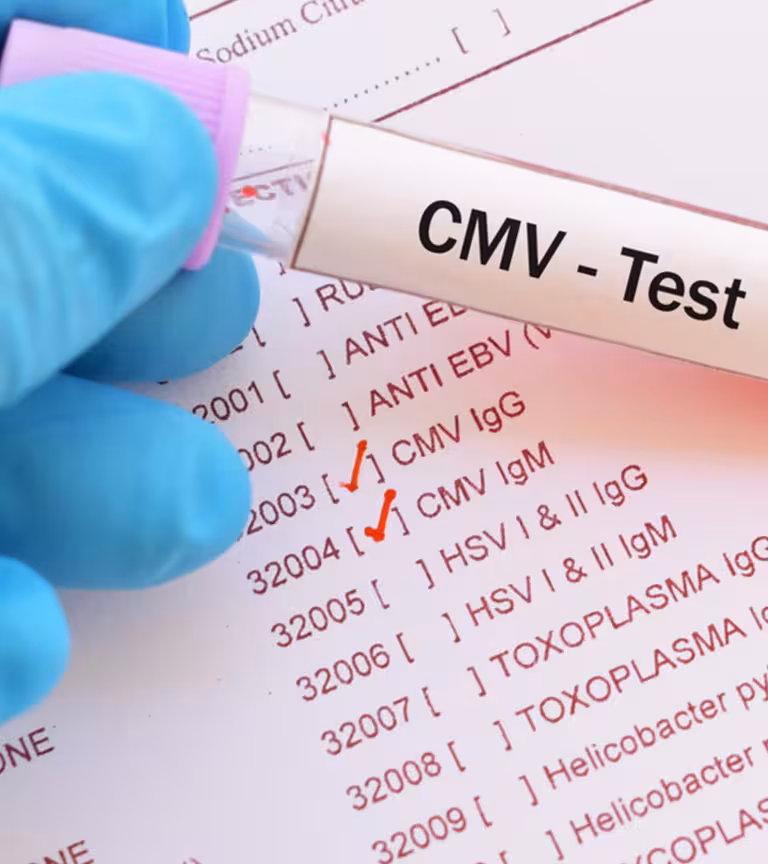 Babies Born With CMV: Symptoms, Causes And Treatment