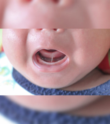 Your pediatrician should know about latching and tongue movement issues in your baby.