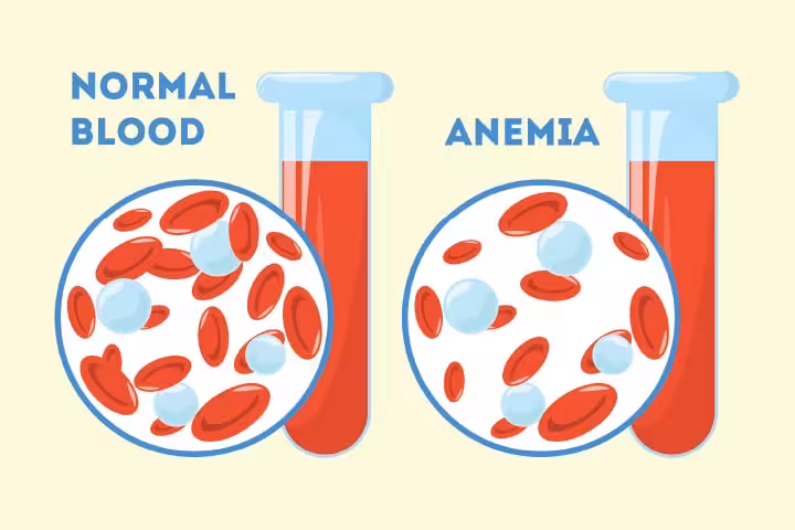 Anemia After Pregnancy In Hindi -1