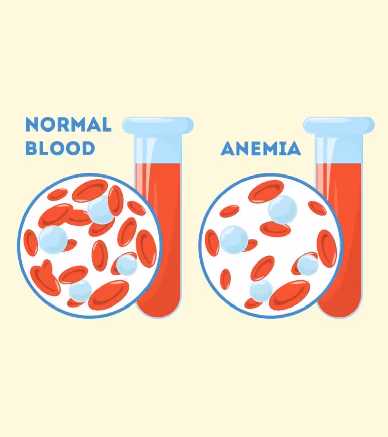 Anemia After Pregnancy In Hindi