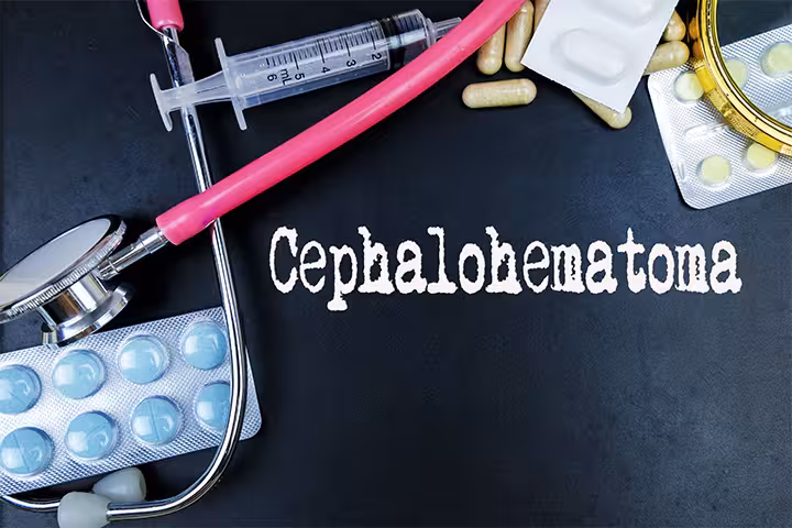 Cephalohematoma In Newborns