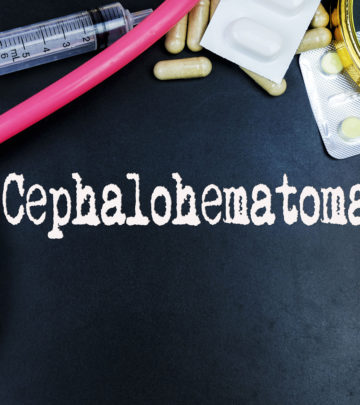 Cephalohematoma In Newborns: Causes, Symptoms And Treatment