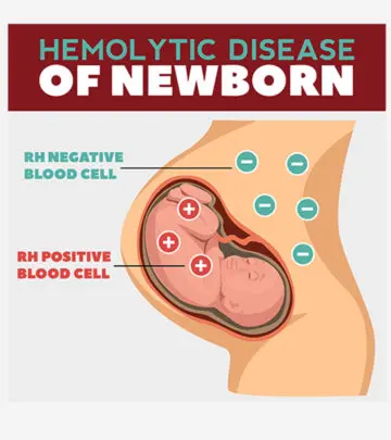 Fetal ultrasound may reveal symptoms of hemolysis, aiding early treatment.