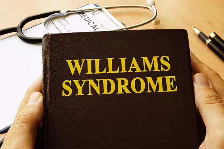  Williams Syndrome In Babies Symptoms, Causes, And Treatment