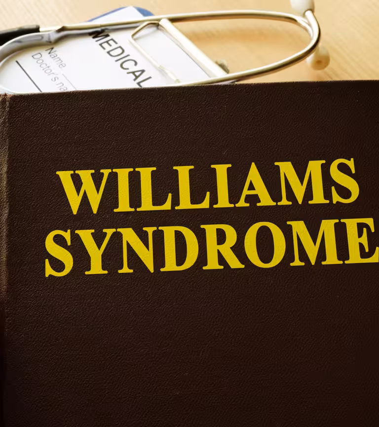  Williams Syndrome In Babies Symptoms, Causes, And Treatment
