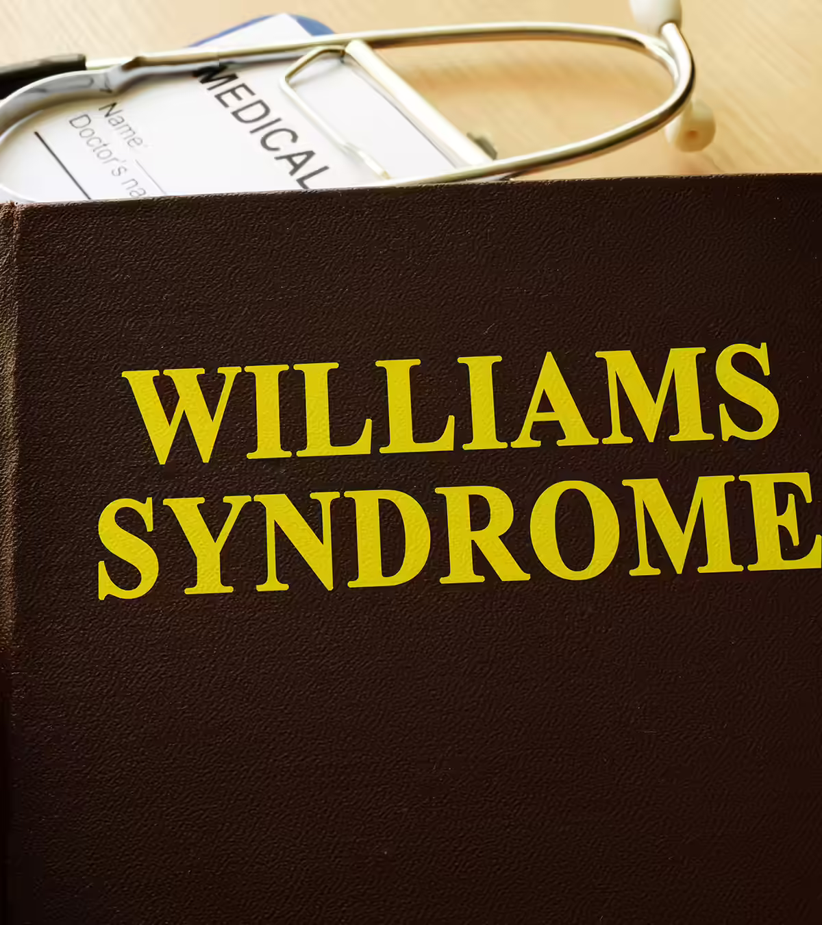  Williams Syndrome In Babies Symptoms, Causes, And Treatment