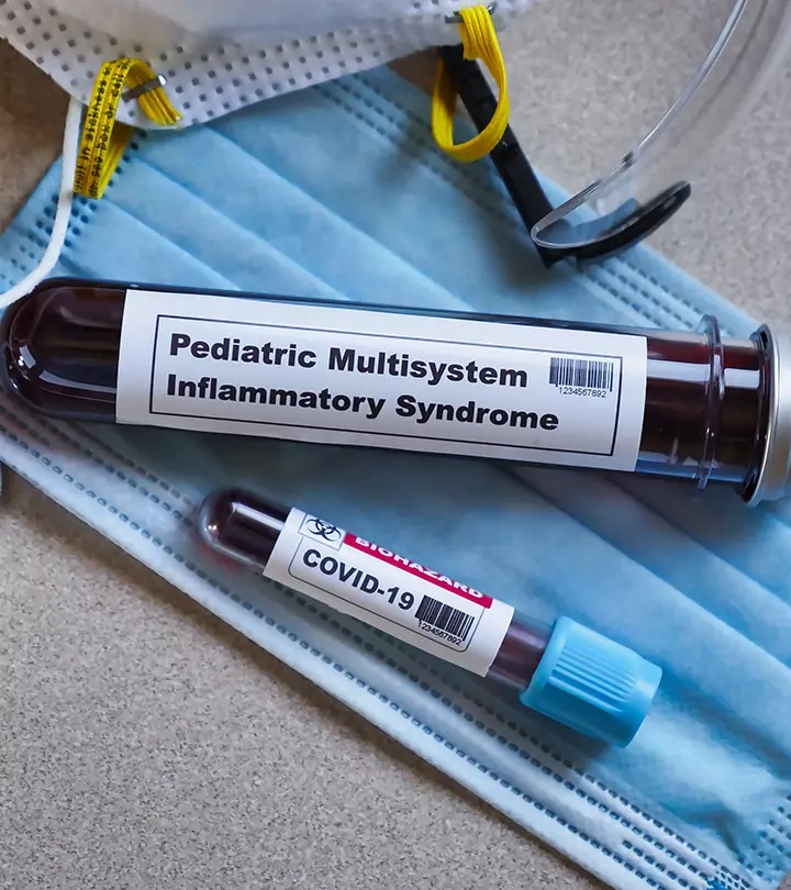 Multisystem Inflammatory Syndrome (MIS-C) In Children