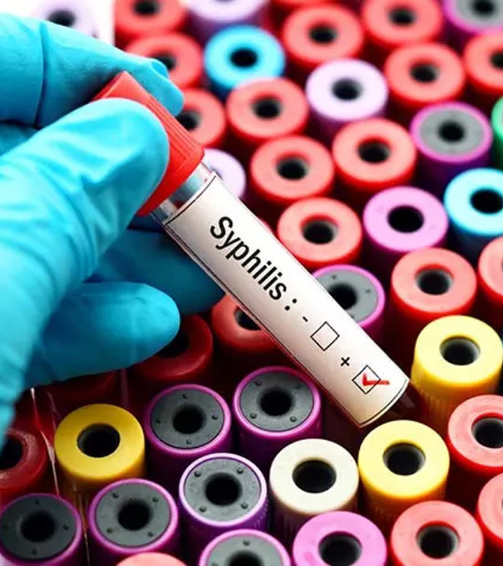 Syphilis In Babies Symptoms, Diagnosis And Treatment