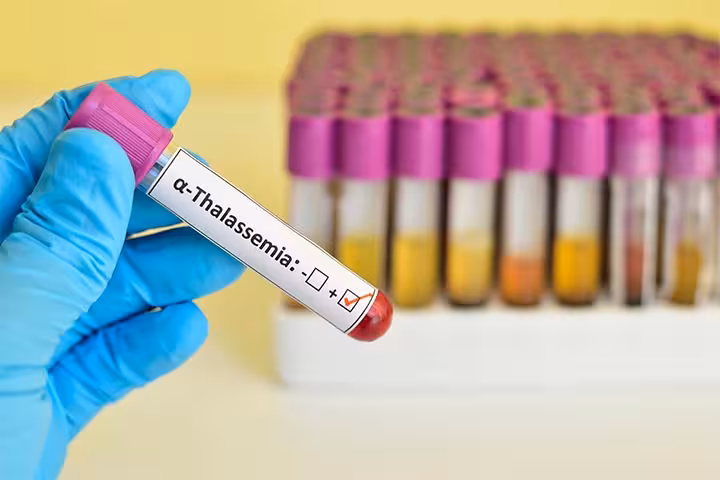 Thalassemia in Pregnancy in Hindi