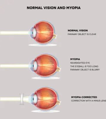 Holding objects closer and headaches are common indicators of myopia or short-sightedness.