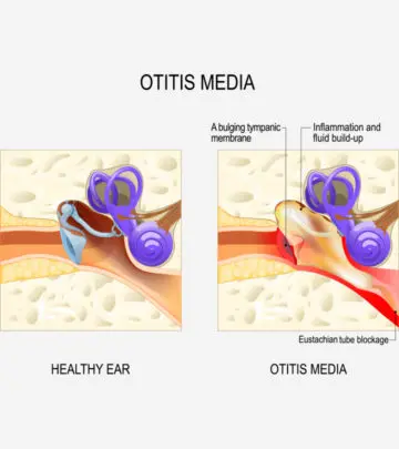 Children experience mild to severe symptoms and are treated with analgesics or antibiotics.