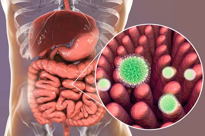 Rotavirus In Children Causes, Symptoms, Risks, And Treatment-1