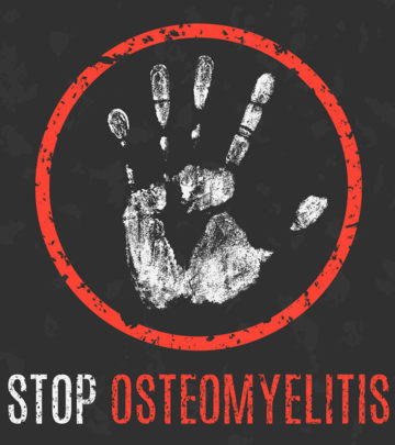 Osteomyelitis In Child Symptoms, Causes, Risks, Treatment And Prevention