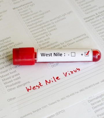 West Nile Virus In Children Symptoms, Complications, And Prevention