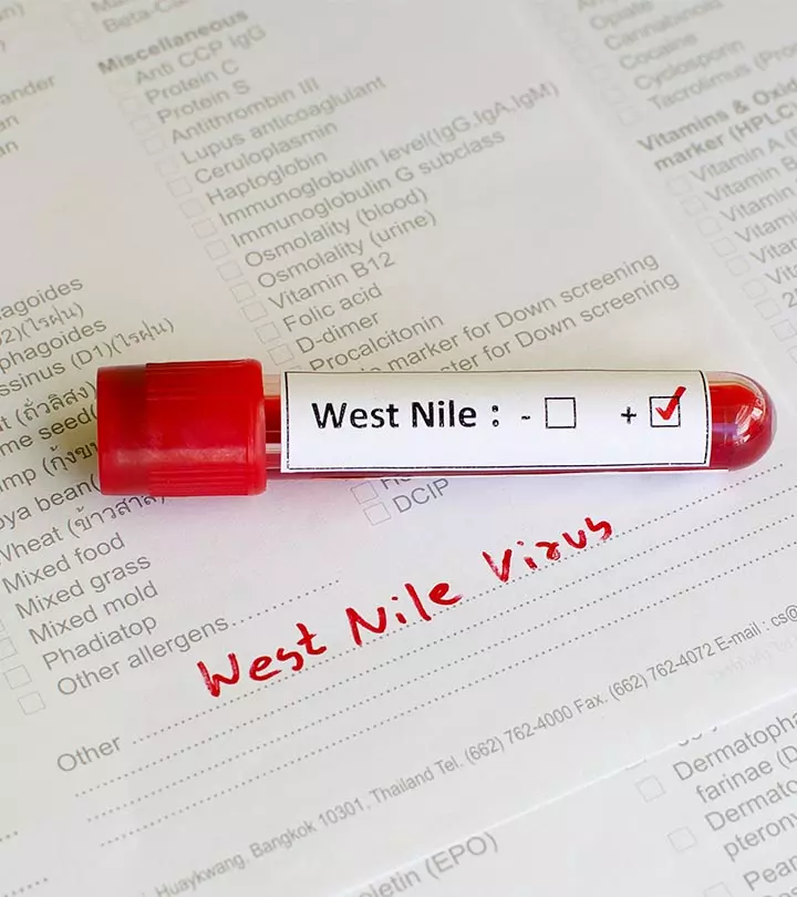 West Nile Virus In Children Symptoms, Complications, And Prevention