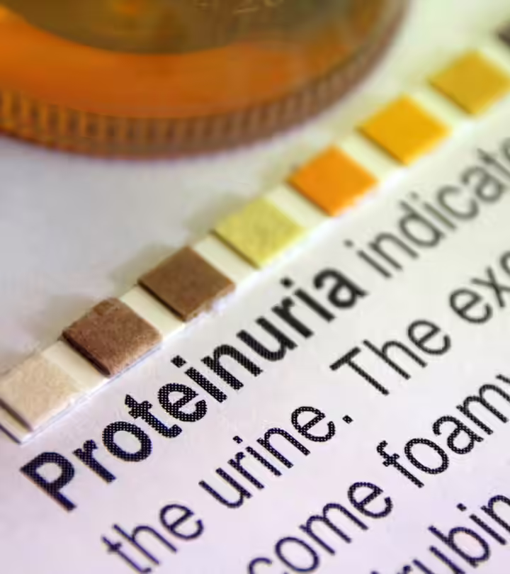 Proteinuria In Children: Causes, Symptoms, Risks, Diagnosis, And Treatment