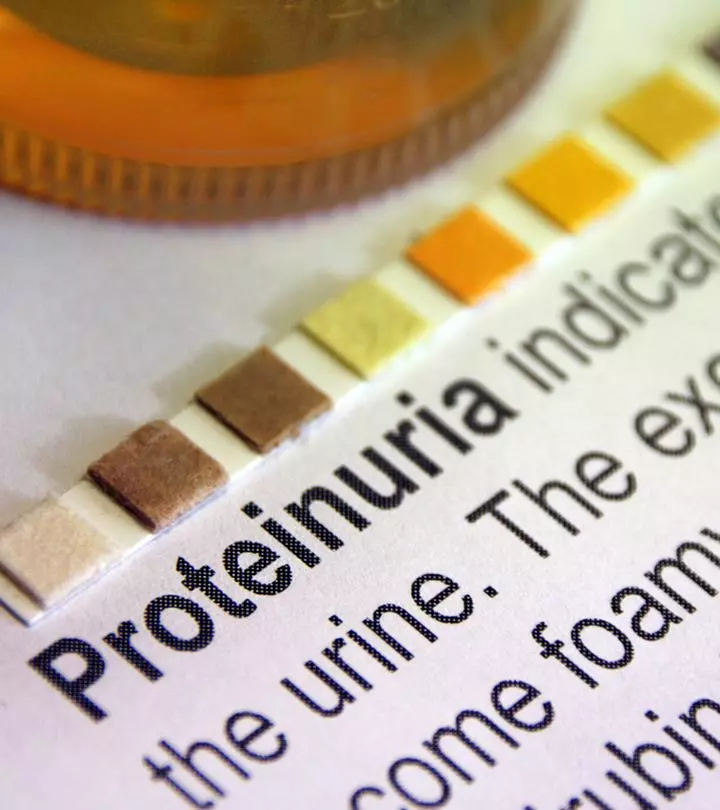 Proteinuria In Children: Causes, Symptoms, Risks, Diagnosis, And Treatment