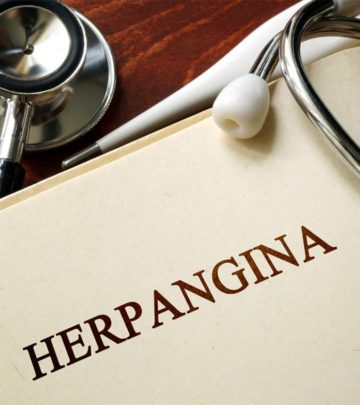 Herpangina In Children Causes, Symptoms, Treatment, And Prevention