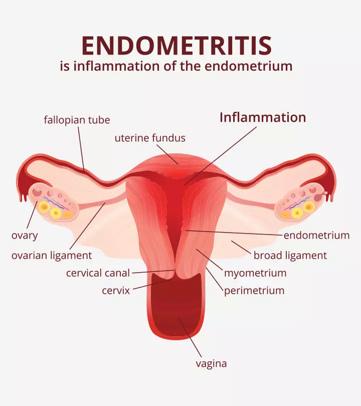 Abdominal pain or abnormal vaginal discharge may indicate uterine infection and inflammation.