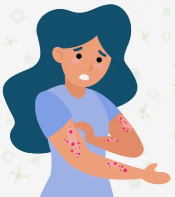 This viral disease rarely occurs when pregnant and may be treated symptomatically.