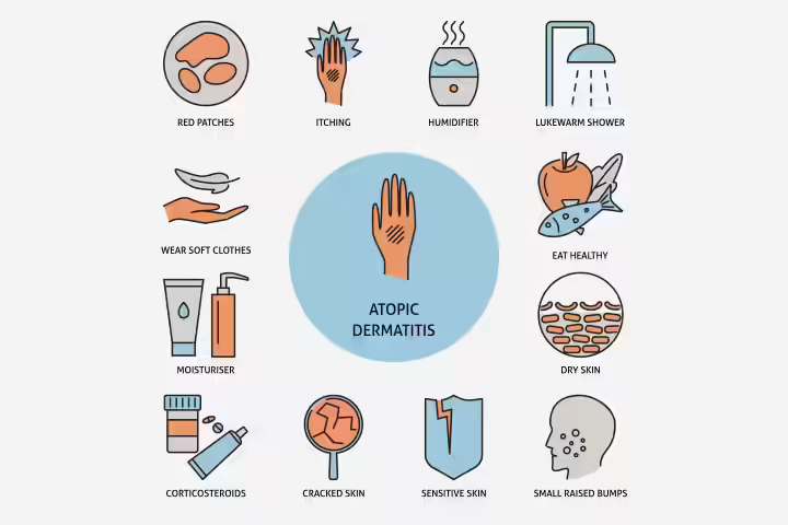 Signs And Symptoms Of Eczema
