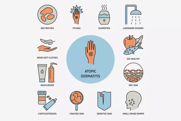 Signs And Symptoms Of Eczema