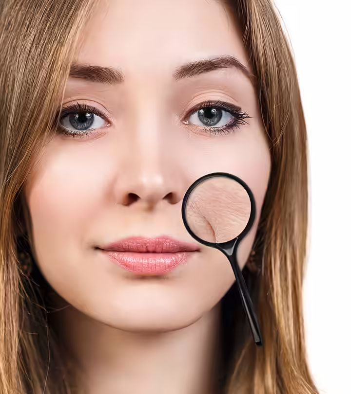Wrinkles At Young Age In Hindi