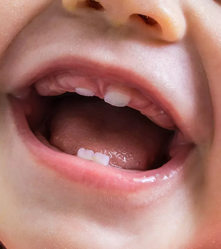 When Do Babies Get Molars Symptoms, Pain Remedies And Care