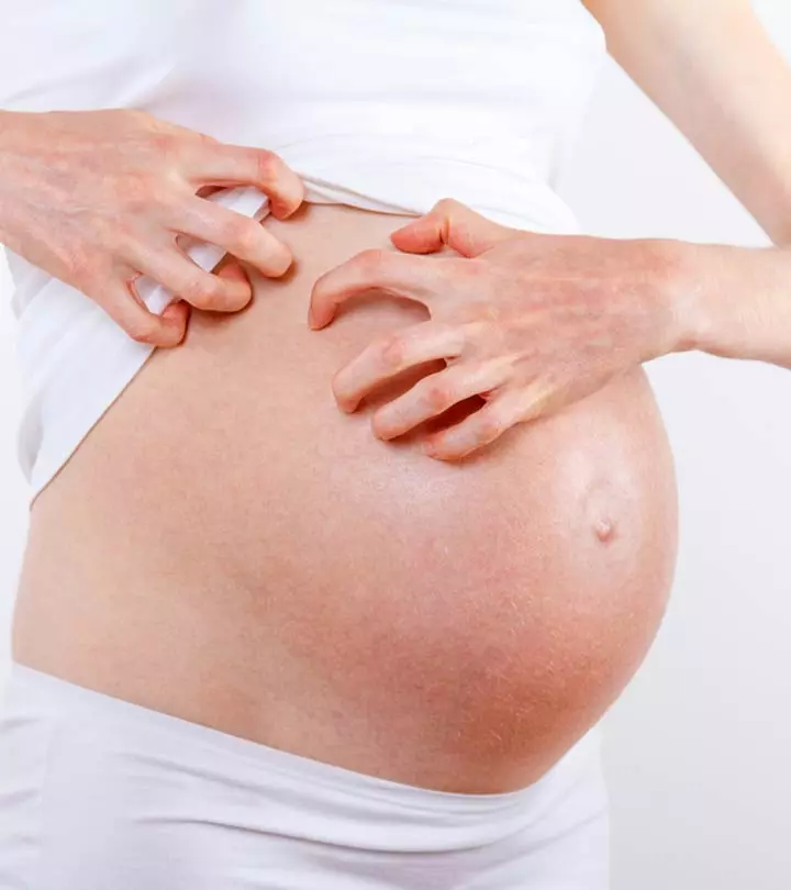 Rashes When Pregnant: Types, Causes And Home Remedies