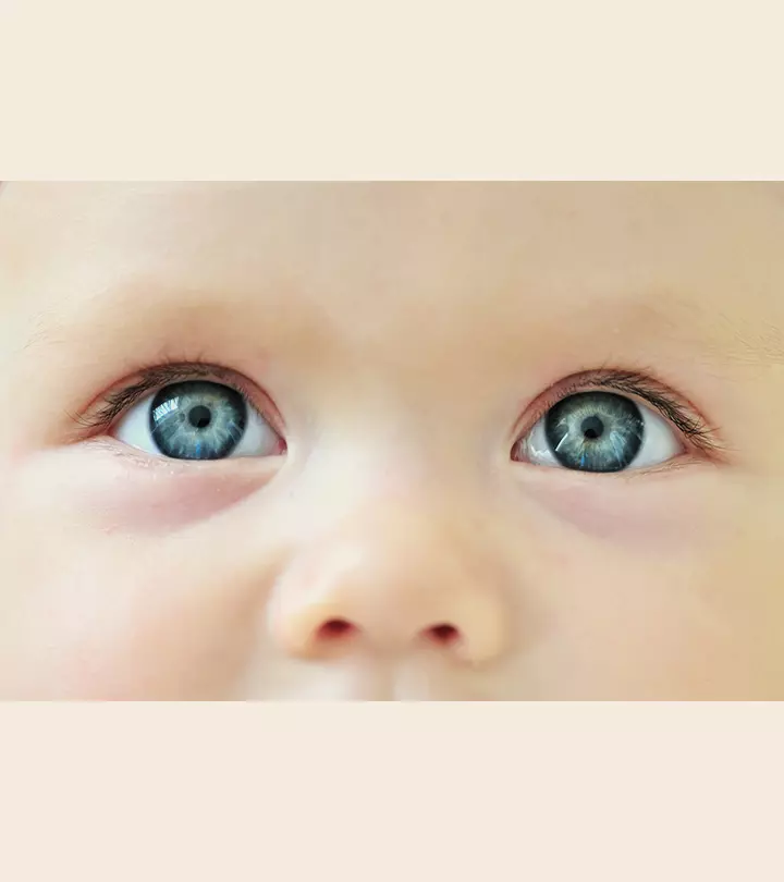 Why Do Babies Get Dark Circles