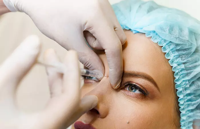 Glabella
