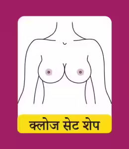 क्लोज सेट शेप (Close Set Shape)