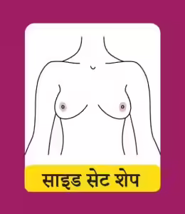 साइड सेट शेप (Side Set Shape)
