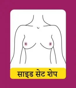 साइड सेट शेप (Side Set Shape)