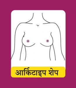 आर्किटाइप शेप (Archetype Shape)