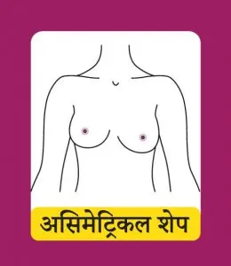 एसमेट्रिकल शेप (Asymmetrical Shape)