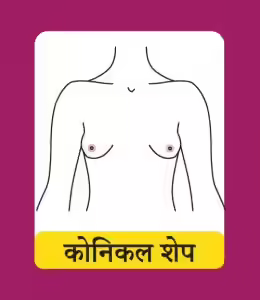 कोनिकल शेप (Conical Shape)