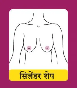 सिलेंडर शेप (Slender Shape)