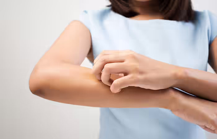 02-Scaly-Looking-Hands-sv