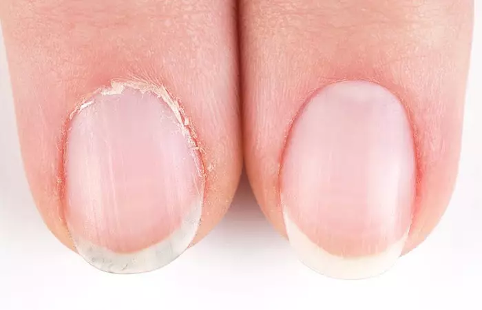 6.-Dry-Cuticles