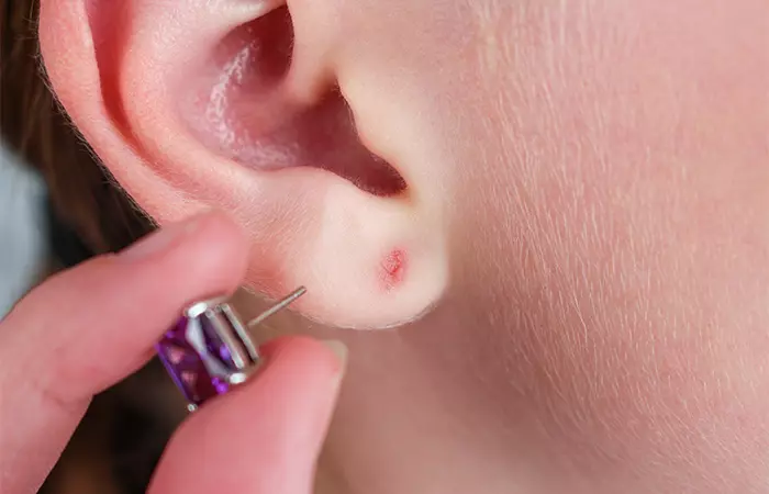 A woman removing jewelry from her ear piercing