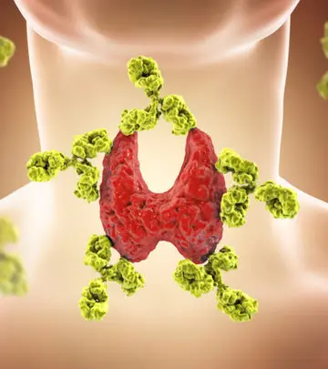 थायराइड के लक्षण, कारण, इलाज और घरेलू उपचार – All About Thyroid in Hindi_image