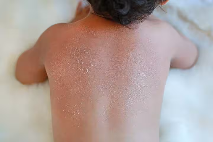Baby ki Dry Skin Care In Hindi