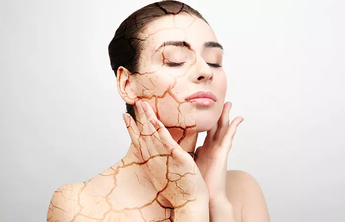 Multani Mitti for dry skin in hindi